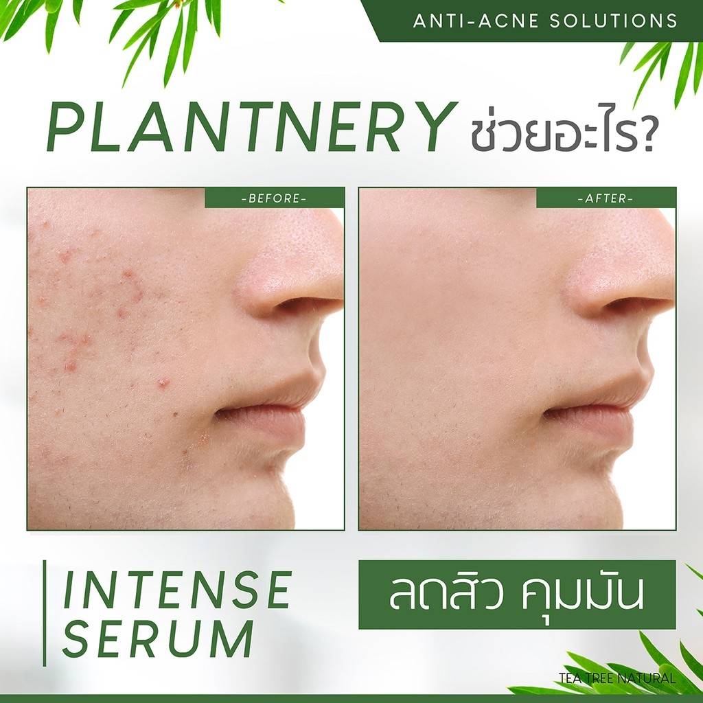 Plantnery Tea Tree Intense Serum